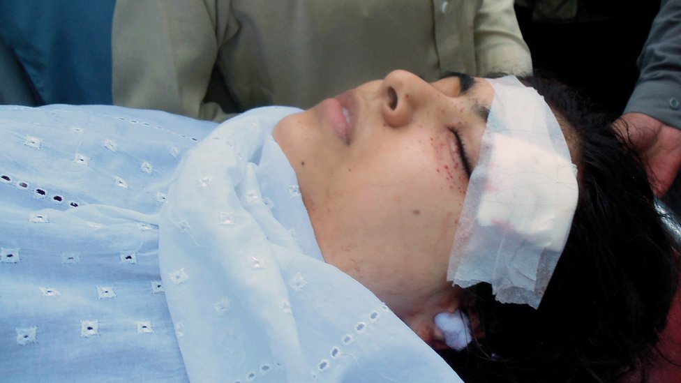 ملالہ یوسفزئی سر میں گولی لگنے کے بعد