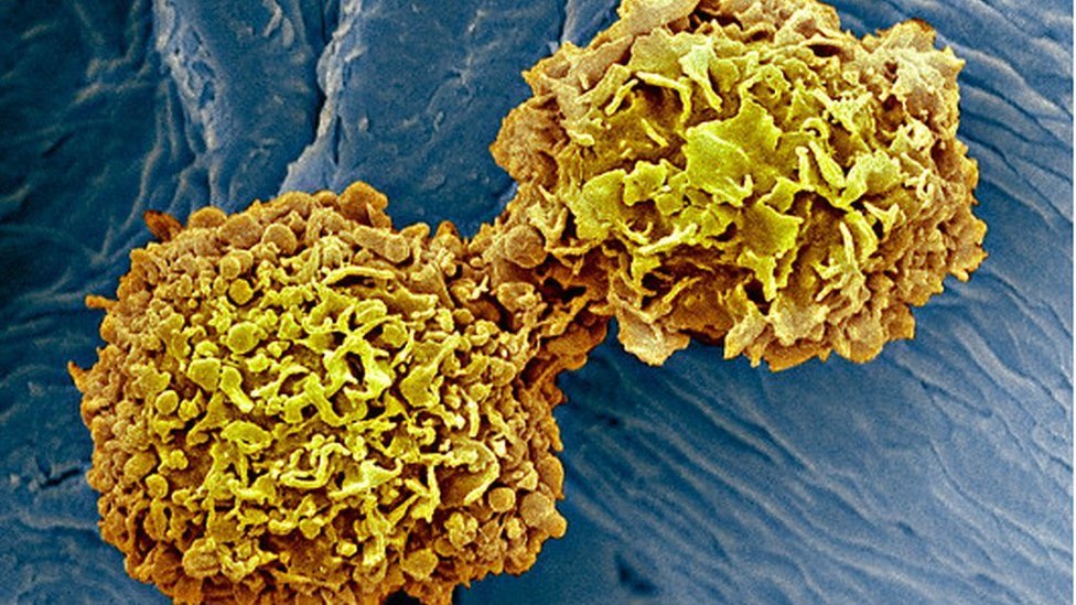 سرطانی خلیے