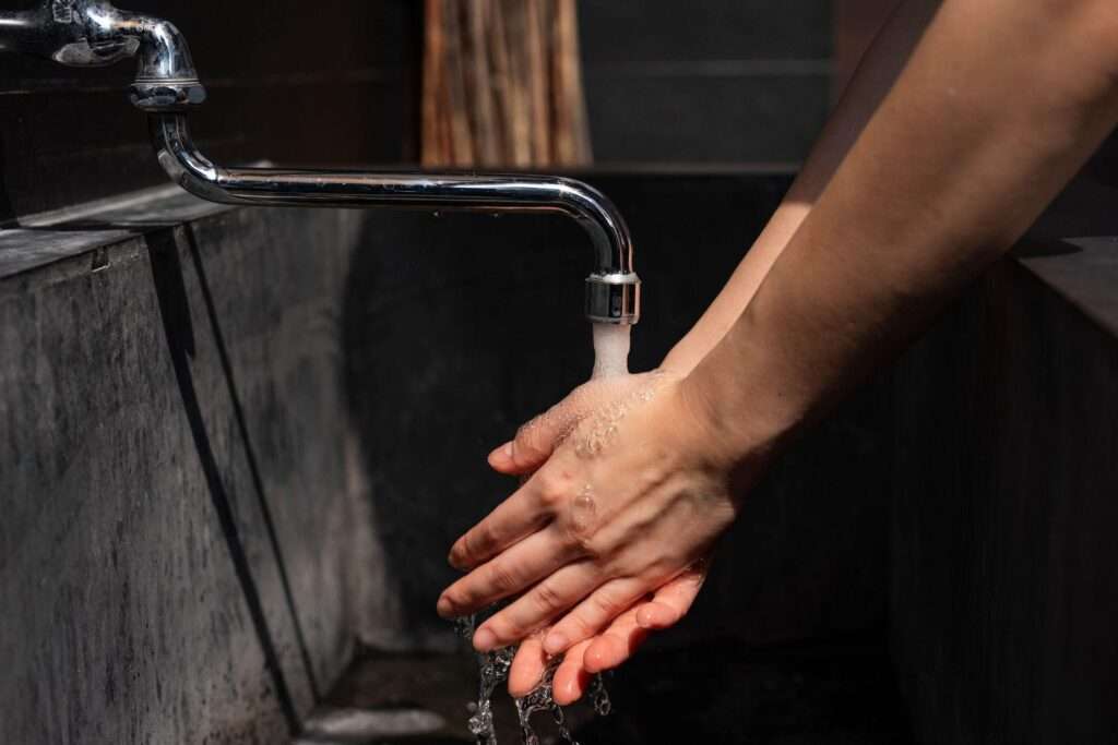 زخمی شخص کو فوری طور برن وارڈ یا قریبی طبی مرکز پہنچانا چائیے